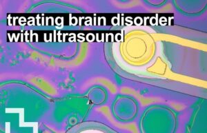 Read more about the article MIT Kembangkan Ultrasound Otak Non-Invasif, Langkah Baru Mengungkap Rahasia Kesadaran
